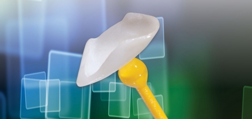 Làm răng sứ Laminate có tốt không? | Tổng hợp thông tin...